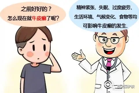 牛皮癣有哪些发病诱因